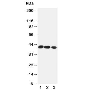 Western blot testing of CCR4 antibody and Lane 1: rat thymus; 2: rat spleen; 3: mouse HEPA cell lysa