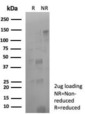SDS-PAGE analysis of purified, BSA-free CD274 antibody (clone rPDL1/8825) as confirmation of integri