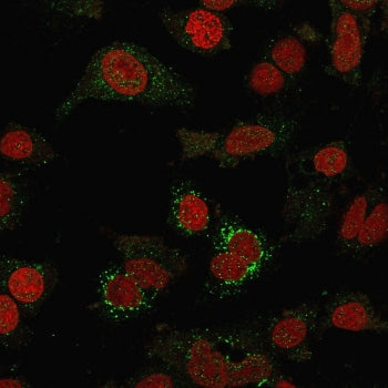 VTCN1 Antibody / B7H4
