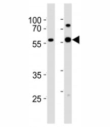 Western blot analysis of lysate from 1) HeLa and 2) MCF-7 cell line using GATA6 antibody at 1:1000.