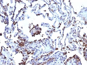 CD63 Antibody Cocktail / LAMP-3