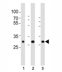 SOD3 Antibody