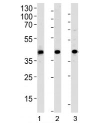 Western blot analysis of 1) human HepG2, 2) mouse kidney and 3) rat spleen tissue lysate using ACADL