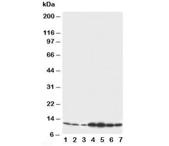 S100 beta Antibody