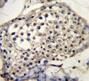 Selenoprotein V Antibody / SELENOV / SELV