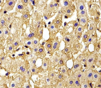 Hemoglobin subunit gamma-2 Antibody / HBG2