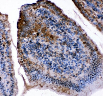 IHC staining of FFPE mouse intestine tissue with FABP5 antibody. HIER: boil tissue sections in pH8 E