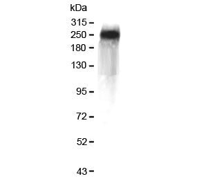 Western blot testing of human plasma with Factor V antibody at 0.5ug/ml. Predicted molecular weight