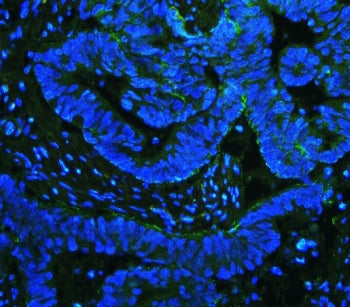 Integrin beta 4 Antibody / ITGB4 / CD104