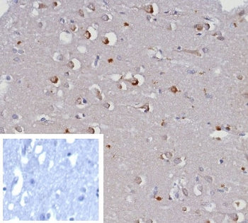 GIRK2 Antibody / KCNJ6