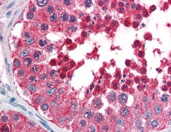 HSPA4L Antibody