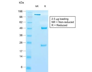 TIMP1 Antibody