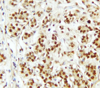 CTBP2 Antibody