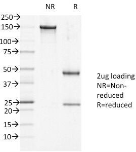 Desmoglein 1 Antibody / DSG1