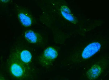 DIO1 Antibody