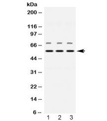 Western blot testing of 1) rat brain, 2) mouse heart and 3) human placenta lysate with Visfatin anti