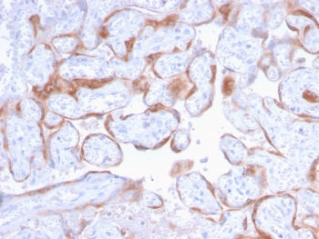 PAPP-A Antibody / Pappalysin-1