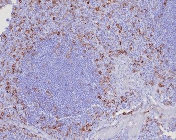 CD162 Antibody / P selectin glycoprotein ligand 1 / PSGL-1