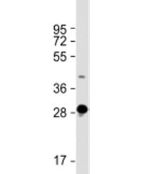 DNASE1L2 Antibody / Deoxyribonuclease-1-like 2