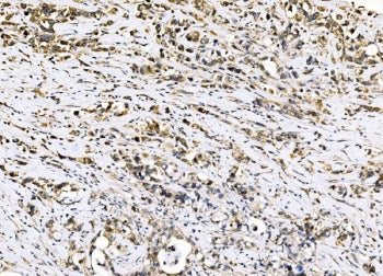 Sigma1-receptor Antibody / SIGMAR1