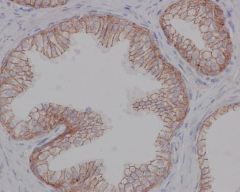 IHC testing of FFPE human prostate with Beta 2 Adrenergic Receptor antibody at 2ug/ml. HIER: steamed antigen retrieval with pH6 citrate buffer.