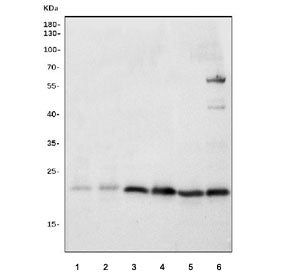mtTFA Antibody / Tfam