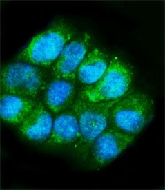 Glutamic-oxaloacetic transaminase 1 Antibody / GOT1