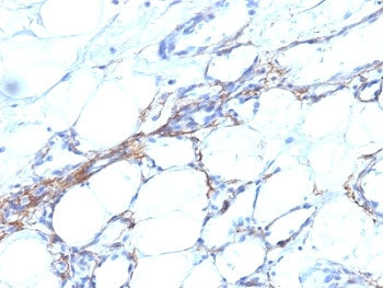 SMMHC Antibody (Smooth Muscle Myosin Heavy Chain)