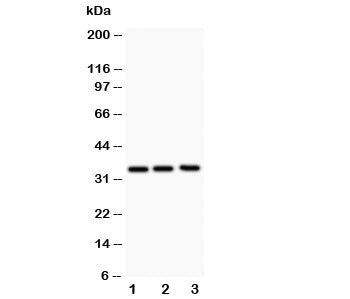 GM-CSF Antibody