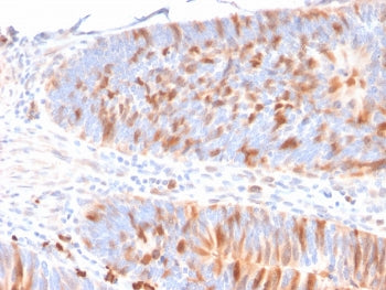 MBD1 Antibody