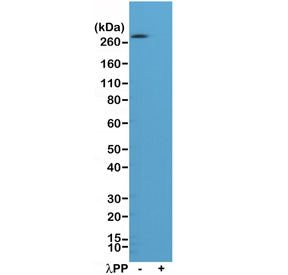 ACC Antibody (pS79) / Acetyl CoA Carboxylase