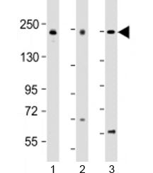 PSME4 Antibody / Proteasome Activator Subunit 4