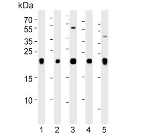 Inosine triphosphate pyrophosphatase Antibody / ITPA / ITPase