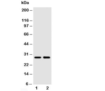 SSX2 Antibody
