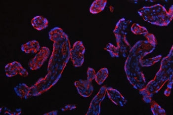 Small ribosomal subunit protein uS7 Antibody / RPS5