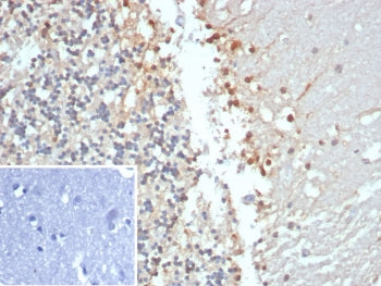 CKB Antibody / Creatine kinase B / Creatine Phosphokinase-BB
