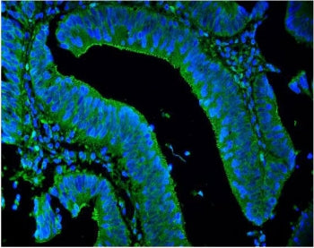 LPP Antibody / Lipoma preferred partner