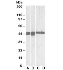 CKM Antibody