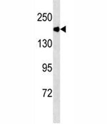 ACE Antibody