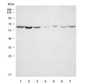 TKTL1 Antibody / Transketolase-like protein 1 / TKR