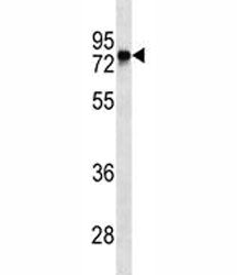 BTK Antibody