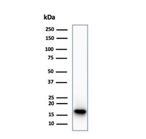 Western blot testing of human HepG2 cell lysate using recombinant CDKN2A antibody (clone CDKN2A/7081