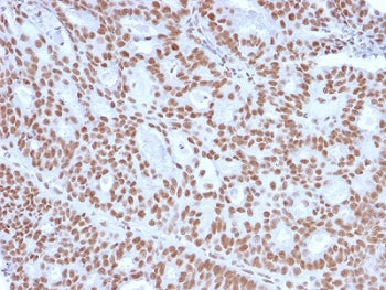 Progesterone Receptor Antibody