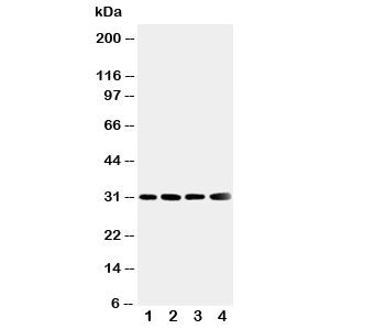 SOD3 Antibody / Superoxide Dismutase 3