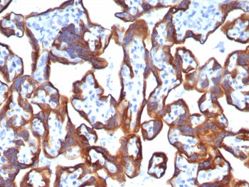 KRT7 Antibody / Cytokeratin 7