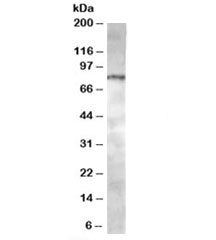 ACAP1 Antibody