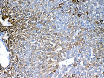 IHC testing of FFPE mouse liver tissue with IGFBP1 antibody at 1ug/ml. Required HIER: steam section