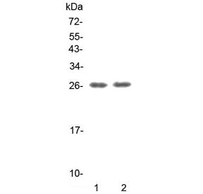 GITR Antibody / TNFRSF18