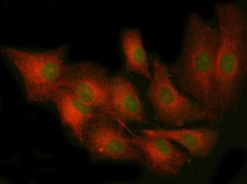 PRKCE Antibody / PKC epsilon