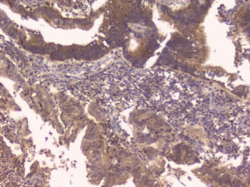 Osteoprotegerin Antibody / TNFRSF11B